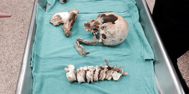 The remains of an unidentified man found in 1992 are shown. (KTAR Photo/Bob McClay)...