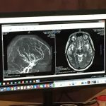 Kristian Knudsen Brain Scans