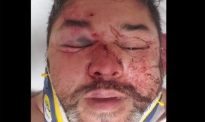 Man claims he was assaulted in homophobic attack in Phoenix