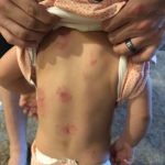 az toddler biting