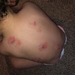 az toddler biting2