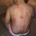 az toddler biting3