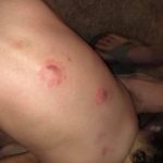 az toddler biting4