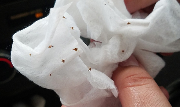 These are the stingers Angelica Aguirre and her husband took out after being attacked by bees at a ...