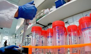 2nd person in Arizona confirmed with presumptive coronavirus