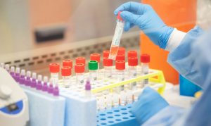 Arizona getting $12M in federal funding to fight coronavirus