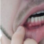 holts-josh-tooth