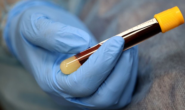 COVID-19 antibody test (Photo by Win McNamee/Getty Images)...