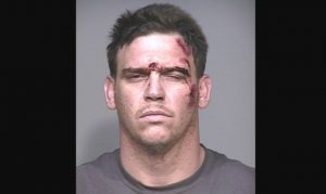 Man arrested after striking Scottsdale officer with car, stealing ambulance
