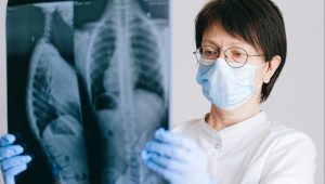Valley oncologist urging lung cancer screening amid concerning rise in nonsmokers