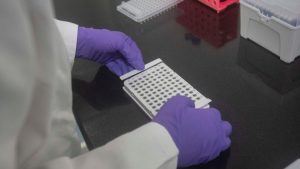 Dignity Health launches study using DNA to determine heart disease risk