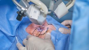 Arizona eye surgery centers agree to settle discrimination claim for $1M