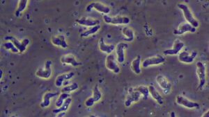 Health officials say suspected case negative for rare brain-eating amoeba in Arizona